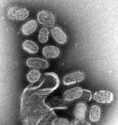 Influenza H1N1 de 1918 em microscopia eletrônica. Fonte: Wikimedia.